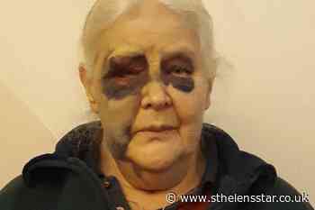 Abhorrent attack on pensioner with leukaemia leaves her badly bruised - St Helens Star