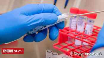 Covid-19 outbreak among students in Ireland led to 442 further cases