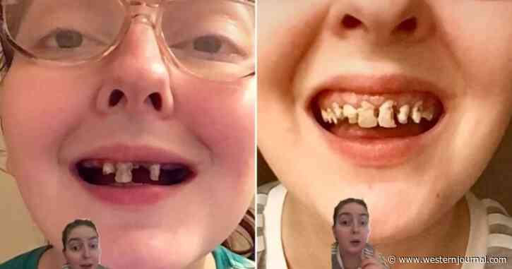 Woman Reveals Bad Habits That Destroyed Her Teeth; One Habit in Particular Hits Home
