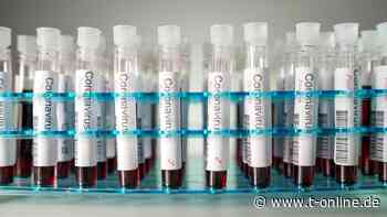 Coronavirus: Großbritannien infiziert Freiwillige - t-online.de