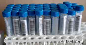 Coronavirus: 121 new COVID cases, 1 additional death confirmed in Simcoe Muskoka - Globalnews.ca