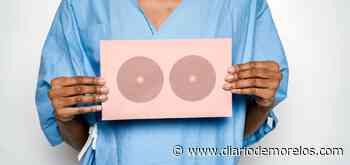 Inicia Cuernavaca campaña de detección de cáncer de mama - Diario de Morelos