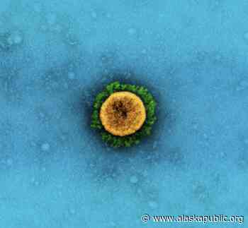Alaska announces four more cases of more-contagious coronavirus strain first seen in Brazil - Alaska Public Media News