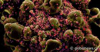 Coronavirus: 20 new cases in London-Middlesex, 13 in Sarnia-Lambton - Global News