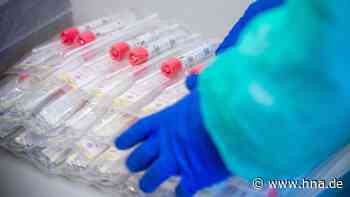 Kostenlose Schnelltests: Testzentren in Bad Hersfeld, Rotenburg, Bebra und Heringen geplant - HNA.de