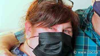 N.B. woman with rare autoimmune disease undergoes high-risk treatment in Ottawa amid pandemic