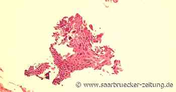 Pathologie des Diakonie Klinikums Neunkirchen: Blick in die Pathologie - Saarbrücker Zeitung