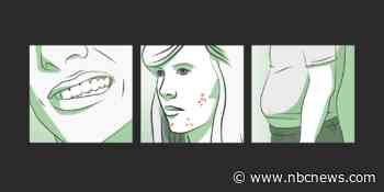 Hair loss, teeth grinding, 'dead butt syndrome': How the pandemic has changed your body