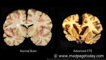 Criteria Proposed to Diagnose Clinical Syndrome Tied to CTE