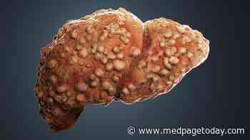 How Does Underlying Cirrhosis Affect COVID-19?