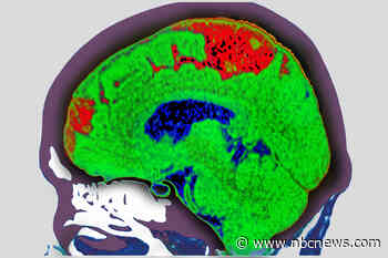 How treating strokes like car crashes could save lives