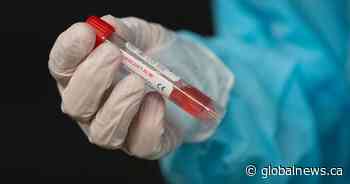 Coronavirus: 11 cases in London-Middlesex; 29 reported in Lambton as region enters lockdown - Global News