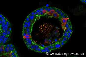 Researchers grow crying human tear glands in the lab - Dudley News