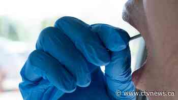 From 'COVID toes' to 'COVID tongues,' new symptoms of COVID-19 continue to emerge