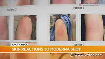 Fact Check: Skin reactions to the Moderna shot?