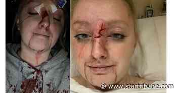 Minneapolis police shot driver with projectile, knocked her out at wheel, lawsuit says