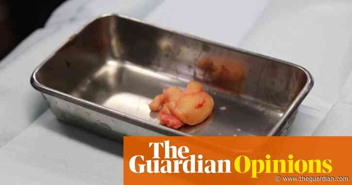 Bogeys, pus and ingrown toenails: the irresistibly gross world of 'ickbait' TV