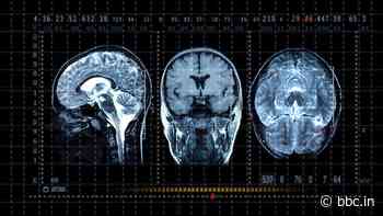 Neuroplasticity: How to rewire your brain