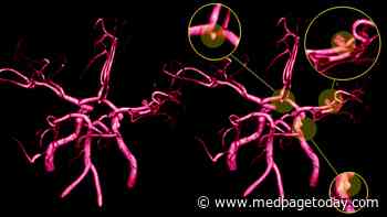Class of Cancer Drug Linked to Aneurysms, Artery Dissections