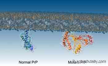 Researchers Discover Crucial Step in Formation of Deadly Brain Diseases