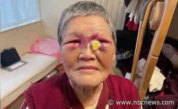 Man arrested after two Asians are assaulted in San Francisco