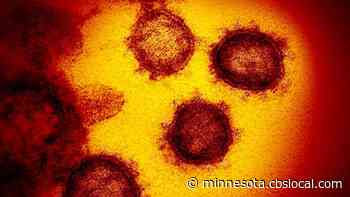 U Of M Medical School Studies Whether Diabetes Drug Is Effective Against COVID - CBS Minnesota