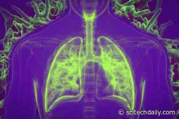 Vaccination by Inhalation – Boosts Immune Responses to Respiratory Infections and Lung Cancer