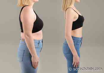 Diabetes Medication Semaglutide Reduces Excess Body Fat in People With Obesity
