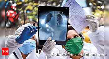 Virus hasn’t lost sting, Mumbai doctors say looking at lung damage in young - Times of India
