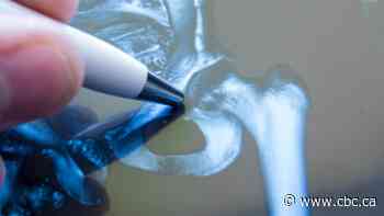 Battle over chiropractors' ability to do routine X-rays headed for B.C. court