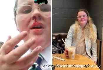 Girl, 13, punched in nose by boy in 'horrid' assault after school