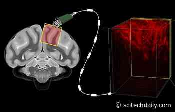 Reading Minds With Ultrasound: Caltech’s New Brain–Machine Interface