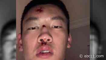 Former UNC basketball player shares account of 2019 attack in Chapel Hill, says Atlanta shootings compelled him to speak out