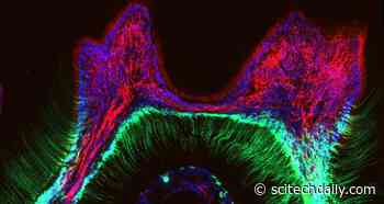 Discovery of How Teeth Sense Cold Explains Age-Old Home Remedy for Toothaches