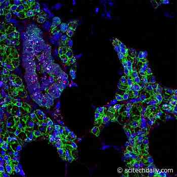 Scientists Find Evidence That Novel Coronavirus Infects Cells in the Mouth – Saliva May Play Role in COVID Transmission
