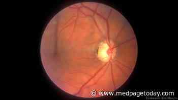 Eyes Offer Window Into Cognitive Impairment