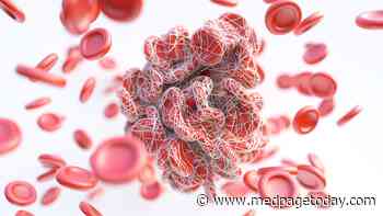 Novel Antithrombotic Misses the Mark in PCI