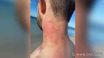 Man comes face-to-face with angry octopus in rare attack