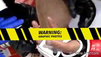 MMA Fighter Loses Finger In Horrific Mid-Match Injury, 'Where The F***' Is It?!
