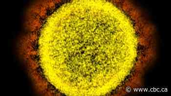 Alberta health officials investigating 2 workplace outbreaks of P1 coronavirus variant