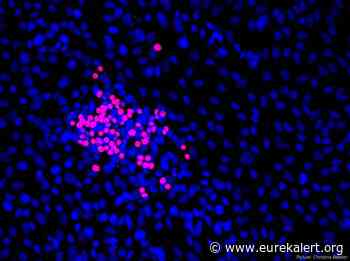 Small cell lung cancer: Scientists identify two new approaches for therapy
