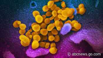 Most kids with serious inflammatory illness had mild COVID