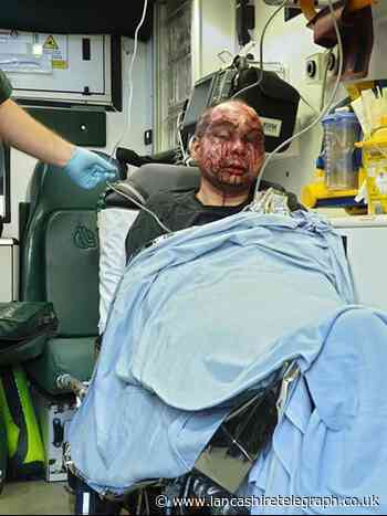 Image shows 'frankly obscene' level of violence inflicted on man during 'horrific assault'