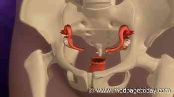 Complications Common in Excision of Retained Cervix After Hysterectomy