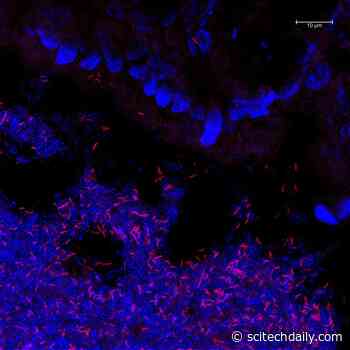Popeye With a Whiff of Rotten Eggs: New Metabolic Capabilities of Gut Bacteria Discovered