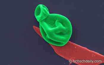 Superbug Killer: New Nanotech Destroys Bacteria and Fungal Cells, While Leaving Human Cells Unharmed