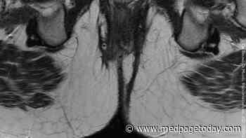Perianal Involvement in Crohn’s Disease: How Bad for Prognosis?