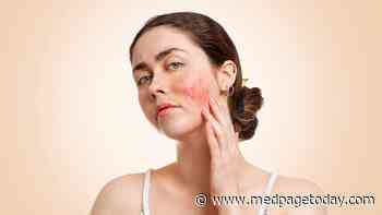 In Lupus, Even Minor Changes in Disease Activity Matter