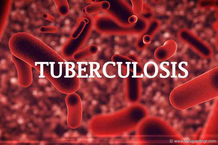 Tuberculosis kills 18 persons per hour in Nigeria ― Report