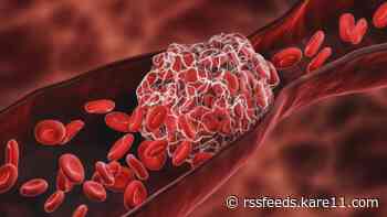 Johnson & Johnson vaccine connected to blood clots, doctors break down what you need to know